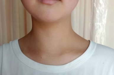 救治急性髓系白血病患者献出您的爱心